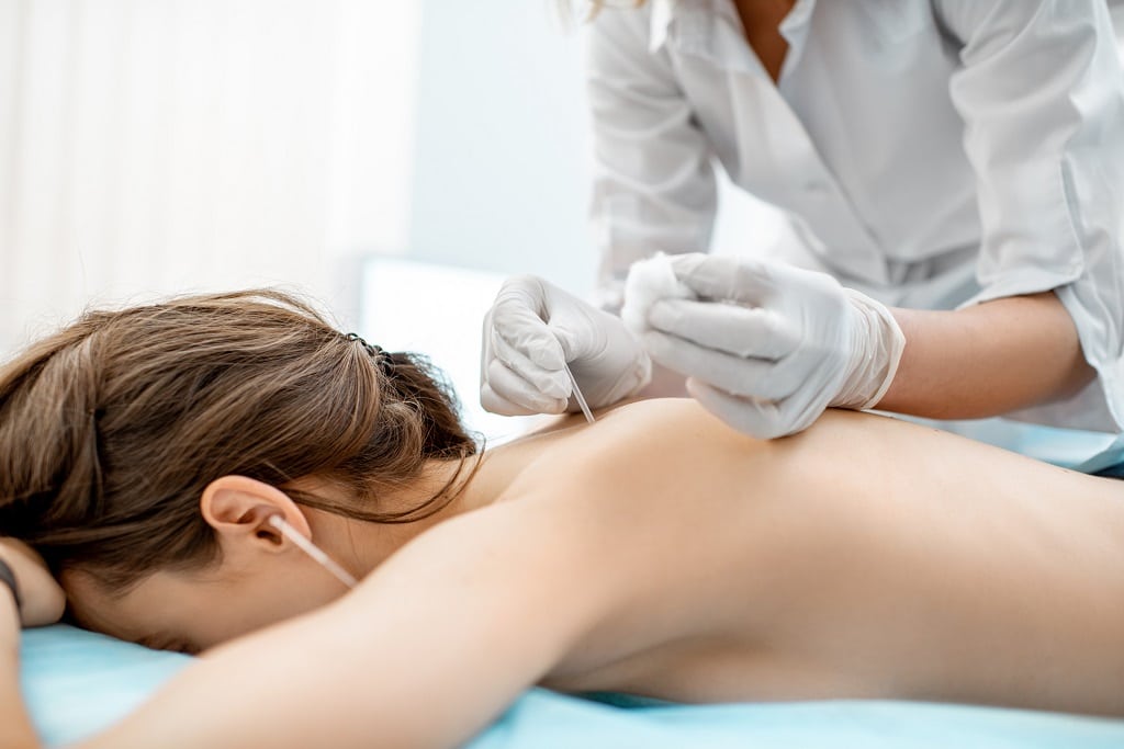 Frau während der Akupunktur-Behandlung in der Praxis - Dr. med. Gerald E. Müller